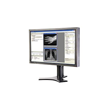 Pleora eBUS SDK (990-1024) Software Demo On Computer Screen